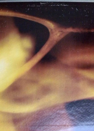 Wishbone Ash : Wishbone Ash (LP, Album, Pin)