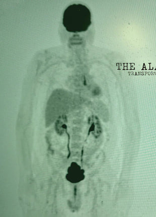 the album cover for The Alarm - Transformation