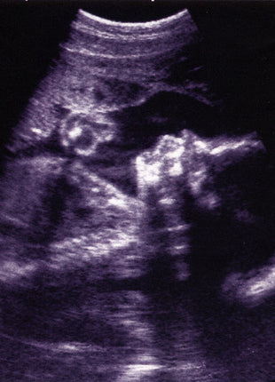 Nirvana : Lithium (CD, Maxi)